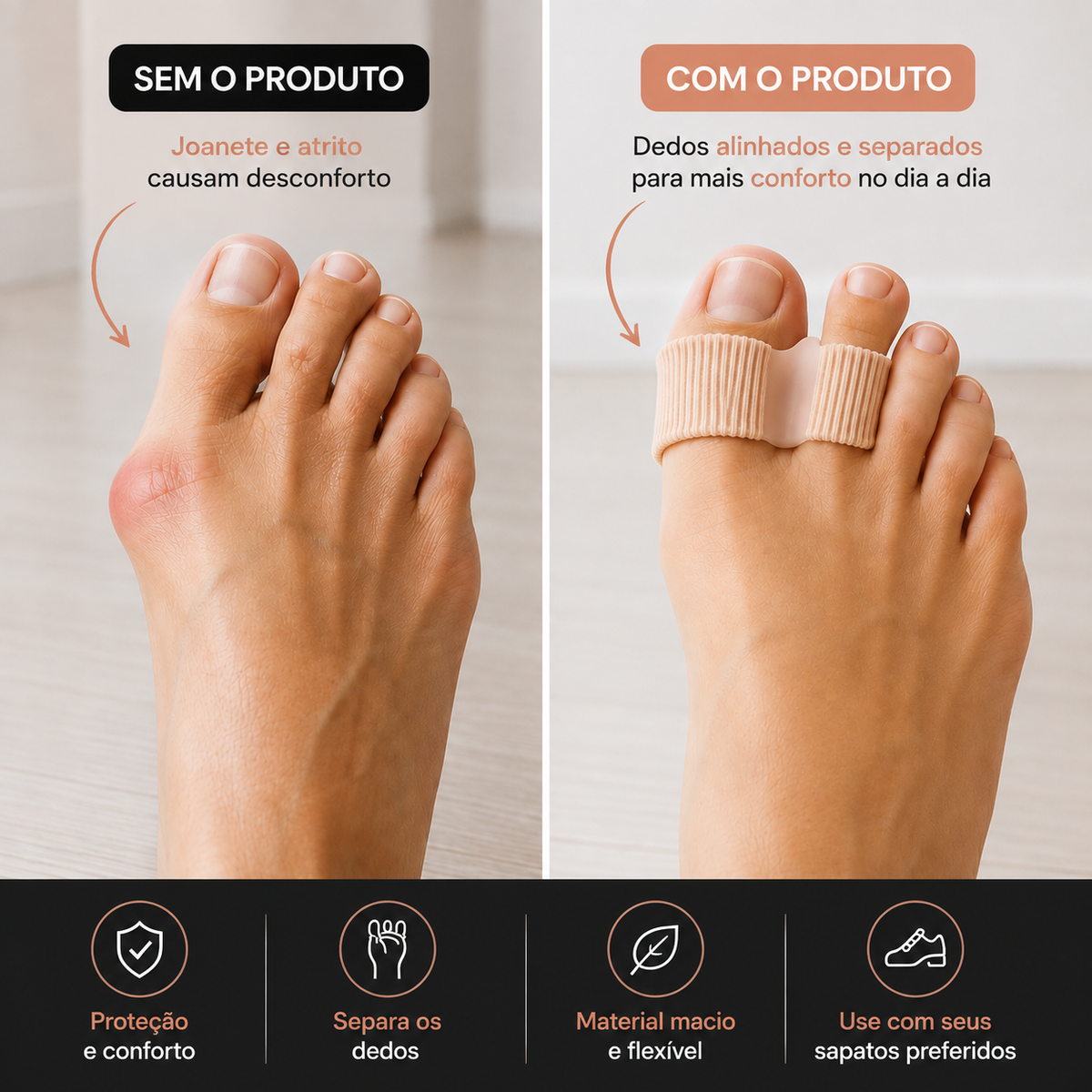Vitallyn AlinhaPé™ – Protetor e Separador para Joanete